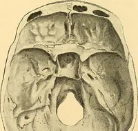 Picture 49 of 93 from Études biologiques sur les géants (1904), leaf 266
