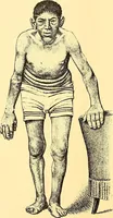 Picture 55 of 93 from Études biologiques sur les géants (1904), leaf 295