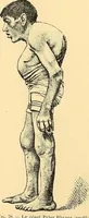 An illustration from Études biologiques sur les géants (1904)