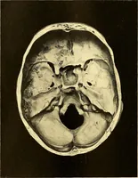 Picture 67 of 93 from Études biologiques sur les géants (1904), leaf 341