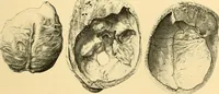 Picture 86 of 93 from Études biologiques sur les géants (1904), leaf 436