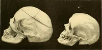 Picture 89 of 93 from Études biologiques sur les géants (1904), leaf 442