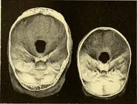 Picture 90 of 93 from Études biologiques sur les géants (1904), leaf 443