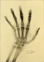 Picture 5 of 93 from Études biologiques sur les géants (1904), leaf 91