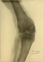 Picture 6 of 93 from Études biologiques sur les géants (1904), leaf 92