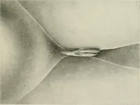 An illustration from Varia africana. I-5 (1917)