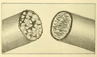 An illustration from Verbatim report of the ... Annual Meeting of the American Street-Railway Association (1884)