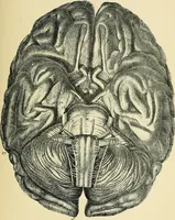 An illustration from A vindication of phrenology (1894)