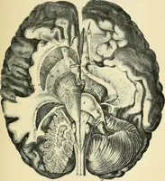 An illustration from A vindication of phrenology (1894)
