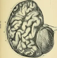 An illustration from A vindication of phrenology (1894)