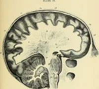 An illustration from A vindication of phrenology (1894)