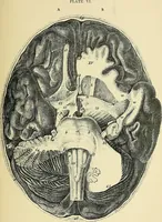 An illustration from A vindication of phrenology (1894)