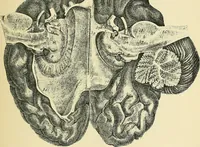 An illustration from A vindication of phrenology (1894)