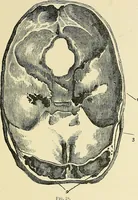 An illustration from A vindication of phrenology (1894)
