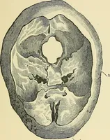 An illustration from A vindication of phrenology (1894)