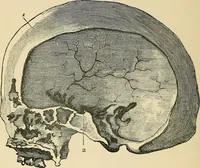 An illustration from A vindication of phrenology (1894)