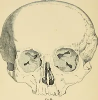 An illustration from A vindication of phrenology (1894)