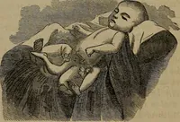 An illustration from Vital resources; (1869)