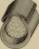 An illustration from Wheels and wheeling; an indispensable handbook for cyclists, with over two hundred illustrations (1892)