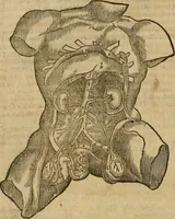 An illustration from The workes of that famous chirurgion Ambrose Parey : (1649)