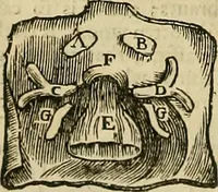 Picture 40 of 336 from The workes of that famous chirurgion Ambrose Parey : (1649), leaf 157