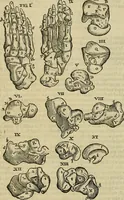 An illustration from The workes of that famous chirurgion Ambrose Parey : (1649)