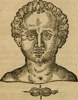 Picture 105 of 336 from The workes of that famous chirurgion Ambrose Parey : (1649), leaf 319