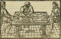 Picture 138 of 336 from The workes of that famous chirurgion Ambrose Parey : (1649), leaf 411