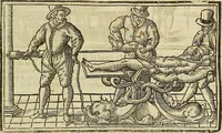 Picture 151 of 336 from The workes of that famous chirurgion Ambrose Parey : (1649), leaf 428