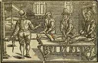 Picture 152 of 336 from The workes of that famous chirurgion Ambrose Parey : (1649), leaf 429