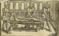 Picture 153 of 336 from The workes of that famous chirurgion Ambrose Parey : (1649), leaf 430