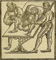 Picture 169 of 336 from The workes of that famous chirurgion Ambrose Parey : (1649), leaf 462