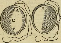 Picture 213 of 336 from The workes of that famous chirurgion Ambrose Parey : (1649), leaf 615
