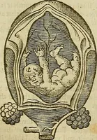 Picture 228 of 336 from The workes of that famous chirurgion Ambrose Parey : (1649), leaf 636