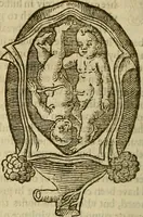 Picture 231 of 336 from The workes of that famous chirurgion Ambrose Parey : (1649), leaf 637