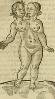 Picture 248 of 336 from The workes of that famous chirurgion Ambrose Parey : (1649), leaf 685