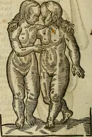 Picture 255 of 336 from The workes of that famous chirurgion Ambrose Parey : (1649), leaf 687