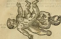 Picture 260 of 336 from The workes of that famous chirurgion Ambrose Parey : (1649), leaf 689
