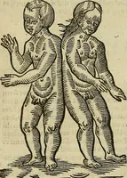 Picture 263 of 336 from The workes of that famous chirurgion Ambrose Parey : (1649), leaf 691