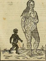 An illustration from The workes of that famous chirurgion Ambrose Parey : (1649)