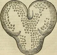 Picture 279 of 336 from The workes of that famous chirurgion Ambrose Parey : (1649), leaf 708