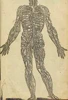 Picture 330 of 336 from The workes of that famous chirurgion Ambrose Parey : (1649), leaf 854