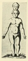 An illustration from Wunder, Wundergeburt und Wundergestalt in Einblattdrucken des fünfzehnten bis achtzehnten Jahrhunderts; kulturhistorische Studie (1921)