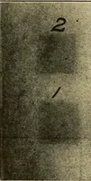 An illustration from X-ray dosage in treatment and radiography (1922)