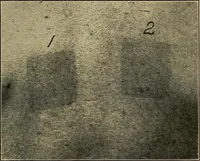An illustration from X-ray dosage in treatment and radiography (1922)