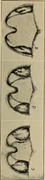 An illustration from X-ray dosage in treatment and radiography (1922)