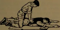An illustration from X-ray manual : U.S. Army (1917)