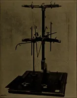 An illustration from X-ray manual : U.S. Army (1917)