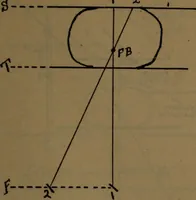 An illustration from X-ray manual : U.S. Army (1917)