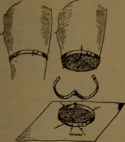 An illustration from X-ray manual : U.S. Army (1917)